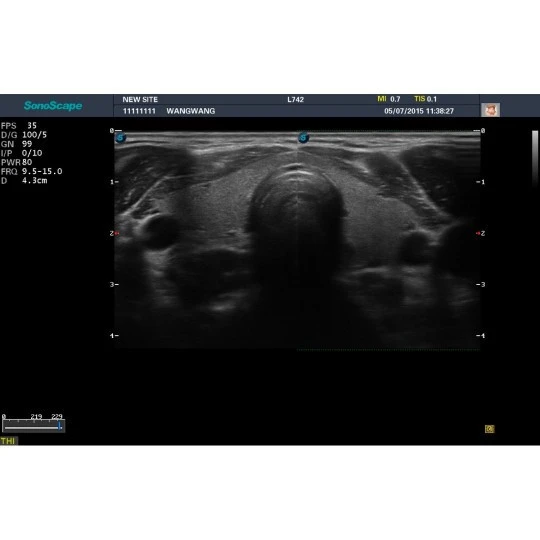 Стационарная ультразвуковая диагностическая система (УЗИ) SonoScape S20Exp