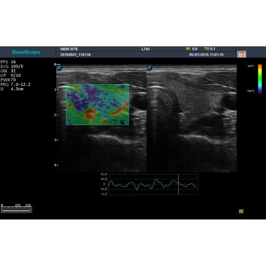 Стационарная ультразвуковая диагностическая система (УЗИ) SonoScape S20Exp
