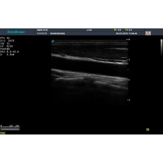 Стационарная ультразвуковая диагностическая система (УЗИ) SonoScape S20Exp