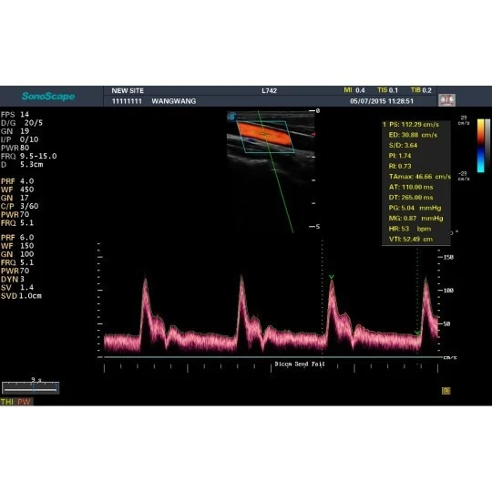 Стационарная ультразвуковая диагностическая система (УЗИ) SonoScape S20Exp