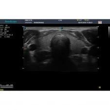 Стационарная ультразвуковая диагностическая система (УЗИ) SonoScape S20Exp