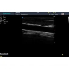 Стационарная ультразвуковая диагностическая система (УЗИ) SonoScape S20Exp