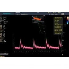 Стационарная ультразвуковая диагностическая система (УЗИ) SonoScape S20Exp