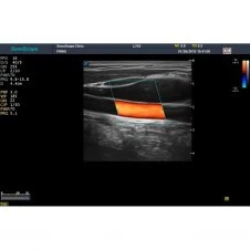 Стационарная ультразвуковая диагностическая система (УЗИ) SonoScape S30
