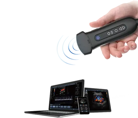 АКЦИЯ! Беспроводная ультразвуковая система Youkey Q7 за 505000 р.